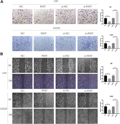 Long Noncoding RNA LINC-PINT Suppresses Cell Proliferation, Invasion, and EMT by Blocking Wnt/β-Catenin Signaling in Glioblastoma